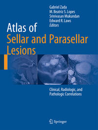 Vorderes Coverbild Atlas of Sellar and Parasellar Lesions