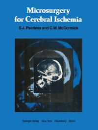 Vorderes Coverbild Microsurgery for Cerebral Ischemia