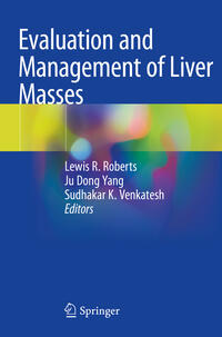 Vorderes Coverbild Evaluation and Management of Liver Masses