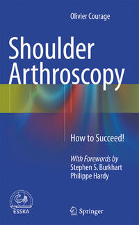 Vorderes Coverbild Shoulder Arthroscopy