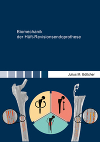 Vorderes Coverbild Biomechanik der Hüft-Revisionsendoprothese