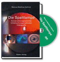 Vorderes Coverbild Die Spaltlampe
