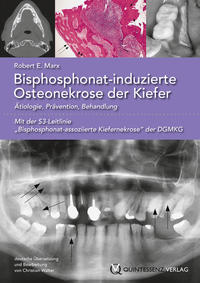 Vorderes Coverbild Bisphosphonat-induzierte Osteonekrose der Kiefer