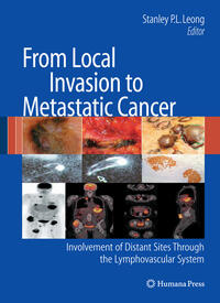 Vorderes Coverbild From Local Invasion to Metastatic Cancer