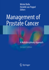Vorderes Coverbild Management of Prostate Cancer