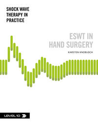 Vorderes Coverbild ESWT in Hand Surgery