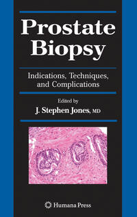 Vorderes Coverbild Prostate Biopsy