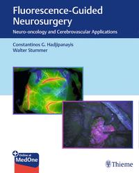 Vorderes Coverbild Fluorescence-Guided Neurosurgery
