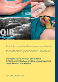 Vorderes Coverbild Infiltrationen peripherer Gelenke