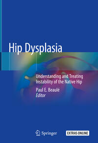 Vorderes Coverbild Hip Dysplasia