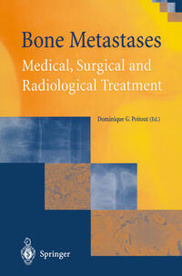 Vorderes Coverbild Bone Metastases