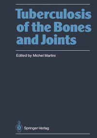 Vorderes Coverbild Tuberculosis of the Bones and Joints