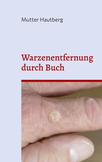 Vorderes Coverbild Warzenentfernung durch Buch