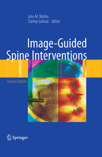 Vorderes Coverbild Image-Guided Spine Interventions
