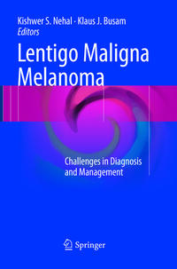 Vorderes Coverbild Lentigo Maligna Melanoma