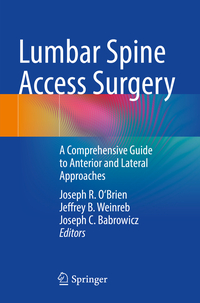 Vorderes Coverbild Lumbar Spine Access Surgery