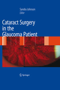 Vorderes Coverbild Cataract Surgery in the Glaucoma Patient