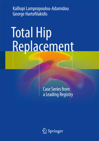Vorderes Coverbild Total Hip Replacement