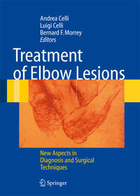 Vorderes Coverbild Treatment of Elbow Lesions