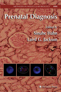 Vorderes Coverbild Prenatal Diagnosis