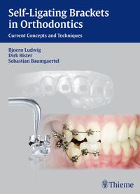 Vorderes Coverbild Self-ligating Brackets in Orthodontics