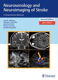 Vorderes Coverbild Neurosonology and Neuroimaging of Stroke