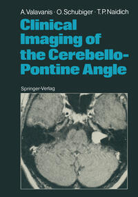 Vorderes Coverbild Clinical Imaging of the Cerebello-Pontine Angle