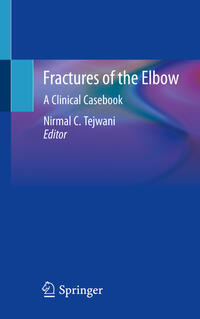 Vorderes Coverbild Fractures of the Elbow