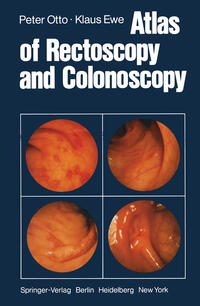 Vorderes Coverbild Atlas of Rectoscopy and Coloscopy
