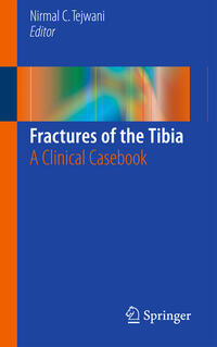Vorderes Coverbild Fractures of the Tibia
