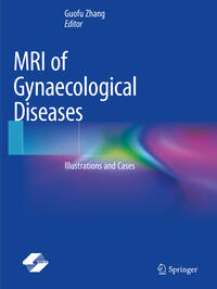 Vorderes Coverbild MRI of Gynaecological Diseases