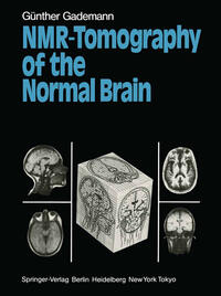 Vorderes Coverbild NMR-Tomography of the Normal Brain