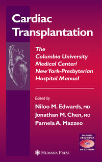 Vorderes Coverbild Cardiac Transplantation