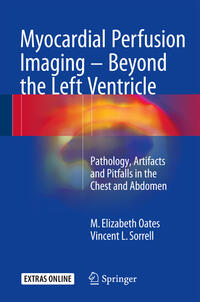 Vorderes Coverbild Myocardial Perfusion Imaging - Beyond the Left Ventricle