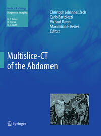 Vorderes Coverbild Multislice-CT of the Abdomen