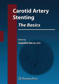 Vorderes Coverbild Carotid Artery Stenting: The Basics