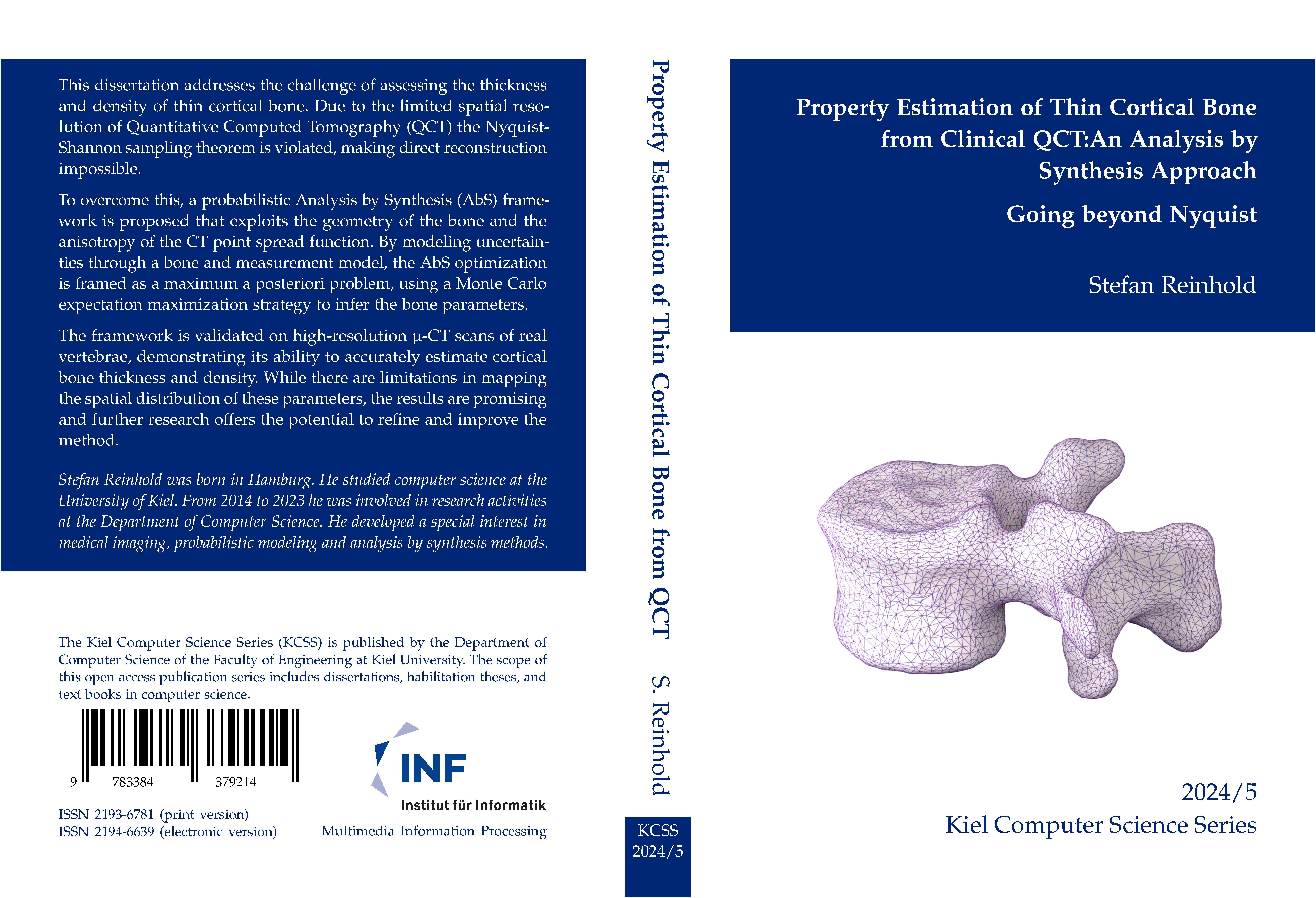 Gesamtes Coverbild Property Estimation of Thin Cortical Bone from Clinical QCT: An Analysis by Synthesis Approach