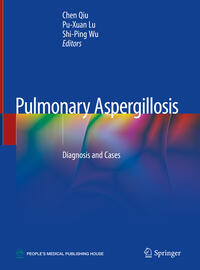 Vorderes Coverbild Pulmonary Aspergillosis