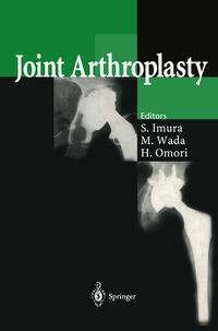 Vorderes Coverbild Joint Arthroplasty