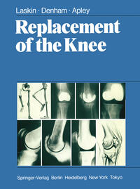 Vorderes Coverbild Replacement of the Knee