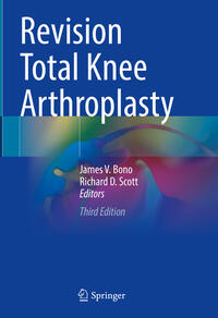 Vorderes Coverbild Revision Total Knee Arthroplasty