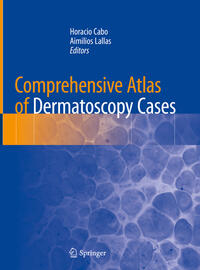 Vorderes Coverbild Comprehensive Atlas of Dermatoscopy Cases