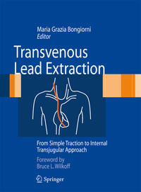 Vorderes Coverbild Transvenous Lead Extraction