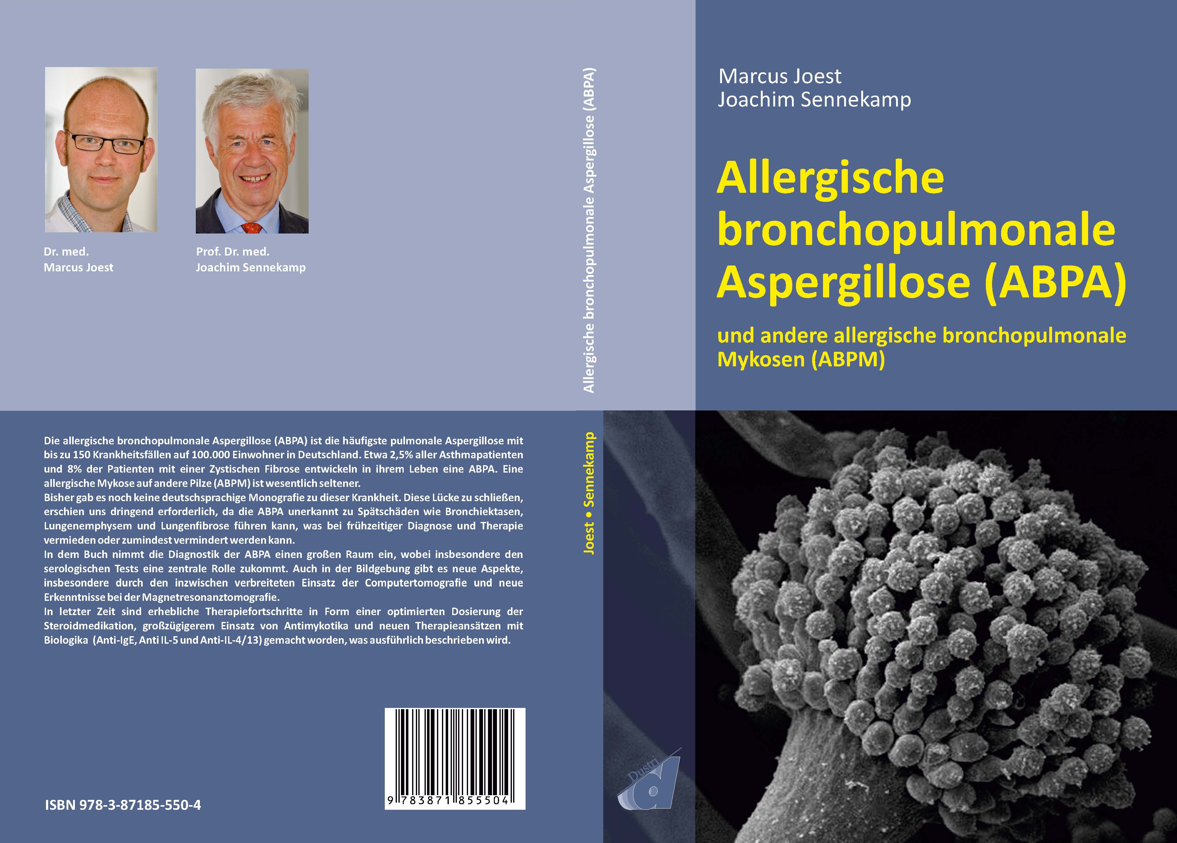 Gesamtes Coverbild Allergische bronchopulmonale Aspergillose (ABPA)