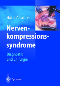 Vorderes Coverbild Nerven-kompressions-syndrome
