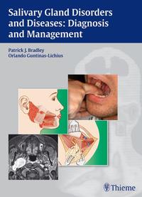 Vorderes Coverbild Salivary Gland Disorders and Diseases: