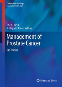 Vorderes Coverbild Management of Prostate Cancer