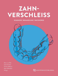 Vorderes Coverbild Zahnverschleiß