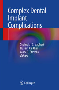 Vorderes Coverbild Complex Dental Implant Complications