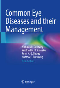 Vorderes Coverbild Common Eye Diseases and their Management